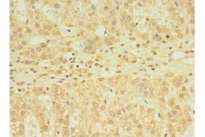 Immunohistochemistry of paraffin-embedded human adrenal gland tissue using ABIN7171119 at dilution of 1:100 (YKT6 anticorps  (AA 10-195))