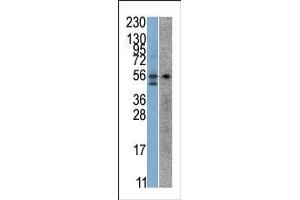 The anti-STK38 Pab is used in Western blot to detect STK38 in SK-Br-3 (left) and Jurkat (right) cell line lysates. (STK38 anticorps  (C-Term))
