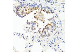 Immunohistochemistry of paraffin-embedded rat lung using FLI20294 antibody at dilution of 1:100 (x40 lens). (AMBRA1 anticorps)