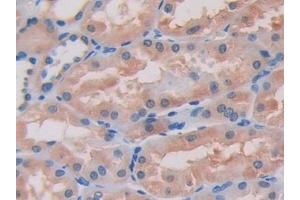 Detection of ITGb1 in Human Kidney Tissue using Polyclonal Antibody to Integrin Beta 1 (ITGb1)