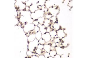 Immunohistochemistry of paraffin-embedded rat lung using VRK1 antibody at dilution of 1:100 (40x lens).