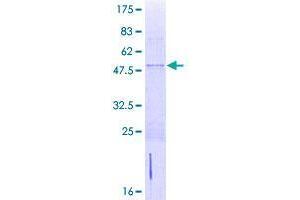 Image no. 1 for Zinc Finger Protein 581 (ZNF581) (AA 1-197) protein (GST tag) (ABIN1326305)
