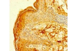 Immunohistochemistry of paraffin-embedded human skin tissue using ABIN7155180 at dilution of 1:100