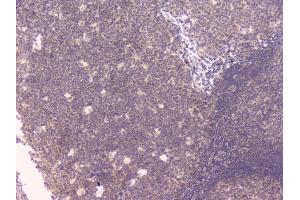 IHC analysis of TNFRSF11B using anti-TNFRSF11B antibody (ABIN7600875).