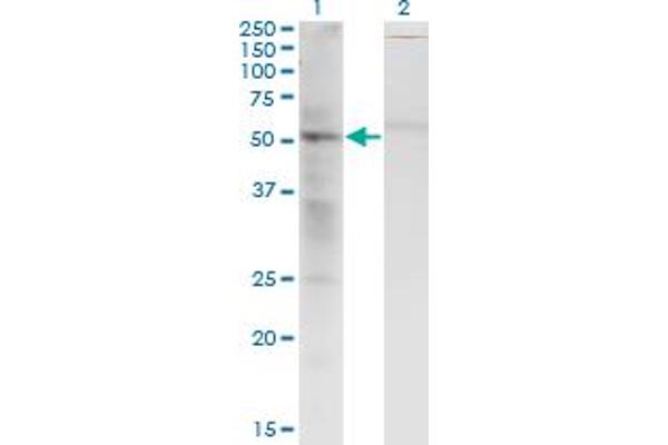 SS18 anticorps  (AA 116-216)