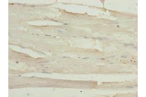 Immunohistochemistry of paraffin-embedded human skeletal muscle tissue using ABIN7143931 at dilution of 1:100 (SGCA anticorps  (AA 24-290))