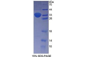 SDS-PAGE analysis of Human PENK Protein. (Enkephalin Protéine)