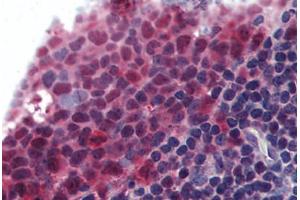 Human Tonsil (formalin-fixed, paraffin-embedded) stained with TNFSF13B antibody ABIN295930 at 10 ug/ml followed by biotinylated goat anti-rabbit IgG secondary antibody ABIN481713, alkaline phosphatase-streptavidin and chromogen. (BAFF anticorps  (AA 254-269))