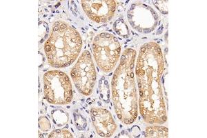 Immunohistochemistry of paraffin embedded human kidney using Clcn5 (ABIN7073471) at dilution of 1:200 (400x lens) (Chloride Channel 5 anticorps)