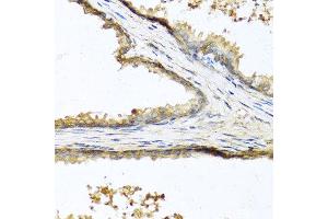 Immunohistochemistry of paraffin-embedded human prostate using SOST antibody at dilution of 1:100 (40x lens). (Sclerostin anticorps)