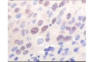 Immunohistochemistry (IHC) image for anti-K(lysine) Acetyltransferase 8 (KAT8) (truncated) antibody (ABIN2464086)