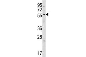 GPC3 antibody western blot analysis in Jurkat lysate