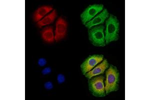 Arc Antibody staining Hela cells by IF/ICC. (Arc anticorps  (Internal Region))