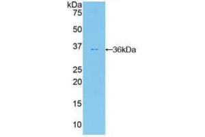 Western blot analysis of recombinant Human PKBb. (AKT2 anticorps  (AA 142-412))