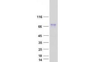 Validation with Western Blot