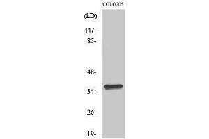 Western Blotting (WB) image for anti-Olfactory Receptor, Family 4, Subfamily A, Member 15 (OR4A15) (C-Term) antibody (ABIN3186083) (OR4A15 anticorps  (C-Term))