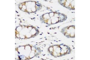 Immunohistochemistry of paraffin-embedded human colon using BMP2 antibody (ABIN5970060) at dilution of 1/200 (40x lens). (BMP2 anticorps)