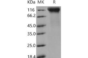 Western Blotting (WB) image for Interleukin 12 Receptor, beta 2 (IL12RB2) (Active) protein (His tag) (ABIN7320408)