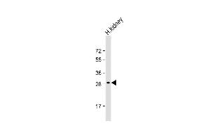 Anti-DIO1 Antibody (N-term) at 1:2000 dilution + human kidney whole cell lysate Lysates/proteins at 20 μg per lane.