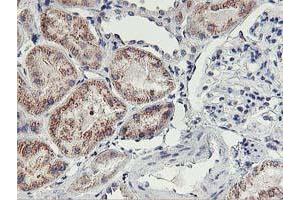 Immunohistochemical staining of paraffin-embedded Human Kidney tissue using anti-HOXC11 mouse monoclonal antibody. (HOXC11 anticorps  (AA 1-304))