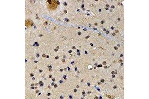 Immunohistochemical analysis of SATB1 staining in rat brain formalin fixed paraffin embedded tissue section. (SATB1 anticorps)