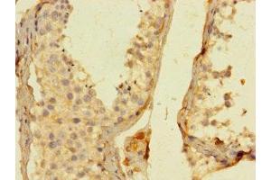 Immunohistochemistry of paraffin-embedded human testis tissue using ABIN7156163 at dilution of 1:100 (PLCL2 anticorps  (AA 2-300))