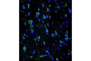 Immunofluorescence (IF) image for anti-Internexin Neuronal Intermediate Filament Protein, alpha (INA) antibody (ABIN2995365) (INA anticorps)