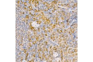 Immunohistochemistry of paraffin-embedded rat spleen using [KO Validated] RA Rabbit pAb (ABIN3021646, ABIN3021647, ABIN3021648 and ABIN1513457) at dilution of 1:100 (40x lens). (RAB5 anticorps  (AA 1-215))