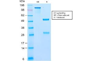 SDS-PAGE Analysis Purified BCL10 Recombinant Rabbit Monoclonal Antibody (BL10/2988R). (Recombinant BCL10 anticorps  (AA 122-168))