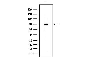 Western blot analysis of lysates from EC304 cells, using ERp72 Mouse Monoclonal Antibody at 1/1000 dilution.