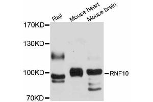 Western blot analysis of extracts of various cell lines, using RNF10 antibody (ABIN5998702) at 1/1000 dilution. (RNF10 anticorps)