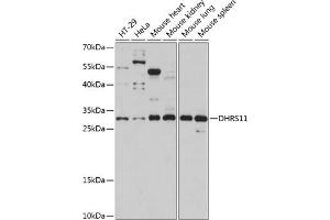 Western blot analysis of extracts of various cell lines, using DHRS11 antibody (ABIN7266723) at 1:1000 dilution. (DHRS11 anticorps  (AA 1-260))