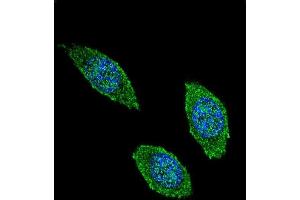 Confocal immunofluorescent analysis of CSF2 Antibody (Center) (ABIN654647 and ABIN2844343) with 293 cell followed by Alexa Fluor 488-conjugated goat anti-rabbit lgG (green). (GM-CSF anticorps  (AA 59-85))