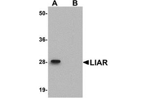 Western Blotting (WB) image for anti-Ankyrin Repeat Domain 54 (ANKRD54) (C-Term) antibody (ABIN1030482) (ANKRD54 anticorps  (C-Term))