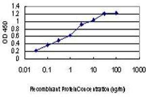 Detection limit for recombinant GST tagged DYRK2 is approximately 0. (DYRK2 anticorps  (AA 1-100))