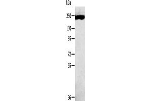 Gel: 6 % SDS-PAGE, Lysate: 40 μg, Lane: K562 cells, Primary antibody: ABIN7191442(MED13 Antibody) at dilution 1/300, Secondary antibody: Goat anti rabbit IgG at 1/8000 dilution, Exposure time: 10 minutes (MED13 anticorps)