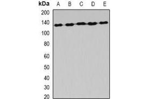 Western blot analysis of AlaRS expression in Hela (A), MCF7 (B), mouse liver (C), mouse brain (D), rat spinal cord (E) whole cell lysates. (AARS2 anticorps)