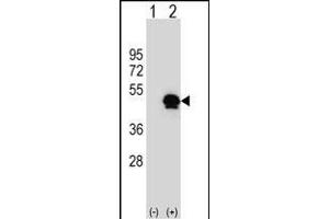 Western blot analysis of SERPINE1 (arrow) using rabbit polyclonal SERPINE1 Antibody (Center) (ABIN656843 and ABIN2846050). (PAI1 anticorps  (AA 188-216))