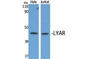Western Blotting (WB) image for anti-Ly1 Antibody Reactive (LYAR) (Internal Region) antibody (ABIN3175884) (LYAR anticorps  (Internal Region))