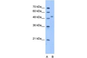 Western Blotting (WB) image for anti-Zinc Finger Protein 763 (ZNF763) antibody (ABIN2463332) (ZNF763 anticorps)