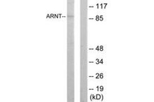 Western blot analysis of extracts from HepG2 cells, using ARNT Antibody. (ARNT anticorps  (AA 31-80))