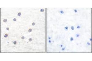 Immunohistochemistry analysis of paraffin-embedded human brain, using Tyrosine Hydroxylase (Phospho-Ser40) Antibody.