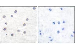 Immunohistochemistry analysis of paraffin-embedded human brain, using Tyrosine Hydroxylase (Phospho-Ser40) Antibody. (Tyrosine Hydroxylase anticorps  (pSer71))