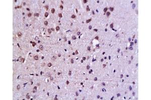 Formalin-fixed and paraffin embedded rat brain tissue labeled Anti-C-Jun Polyclonal Antibody , Unconjugated at 1:200, followed by conjugation to the secondary antibody and DAB staining