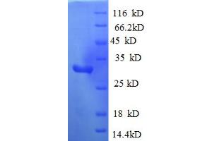 SDS-PAGE (SDS) image for Mitogen-Activated Protein Kinase Kinase Kinase 1 (MAP3K1) (AA 1216-1493), (partial) protein (His tag) (ABIN5712968)
