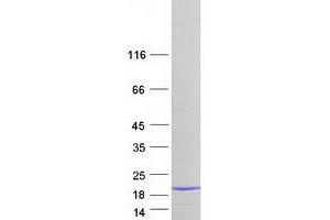 Validation with Western Blot