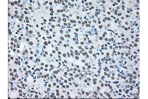 anti-B-Raf proto-oncogene, serine/threonine kinase (BRAF) antibody