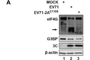 Protease activity of 2A is required for tSG blockage and aSG induction during EV71 infection. (beta Actin anticorps)
