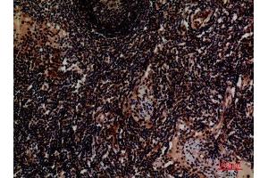 Immunohistochemistry (IHC) analysis of paraffin-embedded Human Lymph, antibody was diluted at 1:100.