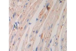 Used in DAB staining on fromalin fixed paraffin- embedded Kidney tissue